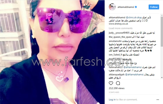 فيديو الفنانة أحلام تعترف باجراء عملية تجميل جديدة من اجل فيديو الفنانة أحلام تعترف باجراء عملية تجميل جديدة من اجل