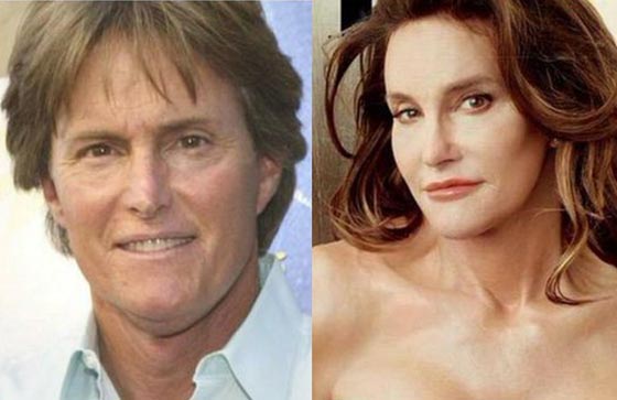 صور نجمات قبل وبعد عمليات التجميل: احداهن دفعت 2 مليون دولار صورة رقم 6 صور نجمات قبل وبعد عمليات التجميل: احداهن دفعت 2 مليون دولار صورة رقم 6