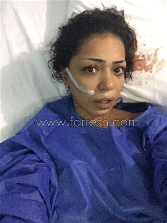 بعد عامين.. عاد المتحرش بفتاة المول المصرية لينتقم بتشويه وجهها صورة رقم 4