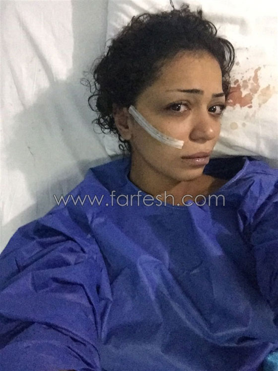 بعد عامين.. عاد المتحرش بفتاة المول المصرية لينتقم بتشويه وجهها صورة رقم 1