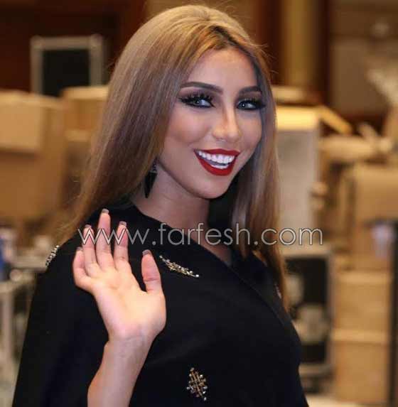 صور صادمة لنجمات عربيات بعد عمليات التجميل بالبوتوكس صورة رقم 6 صور صادمة لنجمات عربيات بعد عمليات التجميل بالبوتوكس صورة رقم 6
