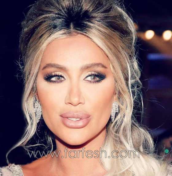 صور صادمة لنجمات عربيات بعد عمليات التجميل بالبوتوكس صورة رقم 3 صور صادمة لنجمات عربيات بعد عمليات التجميل بالبوتوكس صورة رقم 3