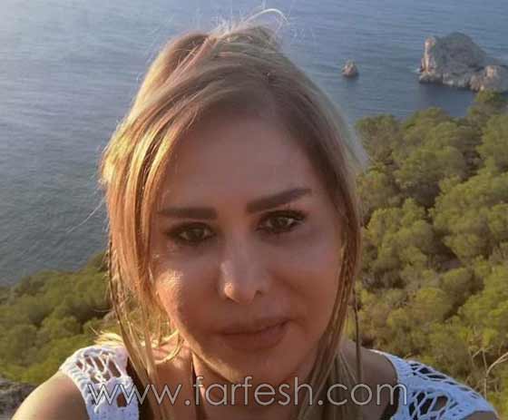 صور صادمة لنجمات عربيات بعد عمليات التجميل بالبوتوكس صورة رقم 14 صور صادمة لنجمات عربيات بعد عمليات التجميل بالبوتوكس صورة رقم 14