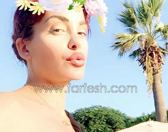 صور صادمة لنجمات عربيات بعد عمليات التجميل بالبوتوكس صورة رقم 2 صور صادمة لنجمات عربيات بعد عمليات التجميل بالبوتوكس صورة رقم 2