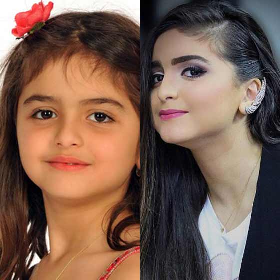 صور مشاهير عرفناهم أطفالاً.. هكذا أصبحوا الآن!! صورة رقم 2 صور مشاهير عرفناهم أطفالاً.. هكذا أصبحوا الآن!! صورة رقم 2