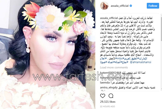 أصالة توجه رسالة لأحلام بعد استبعادها من ذا فويس بشكل مفاجئ صورة رقم 1 أصالة توجه رسالة لأحلام بعد استبعادها من ذا فويس بشكل مفاجئ صورة رقم 1