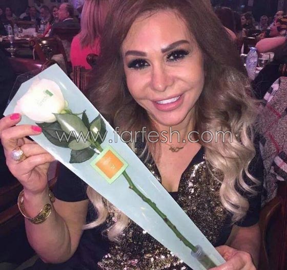 عمليات تجميل فاشلة شوهت الفنانات العربيات بينهن يسرا، غادة وكارمن صورة رقم 9