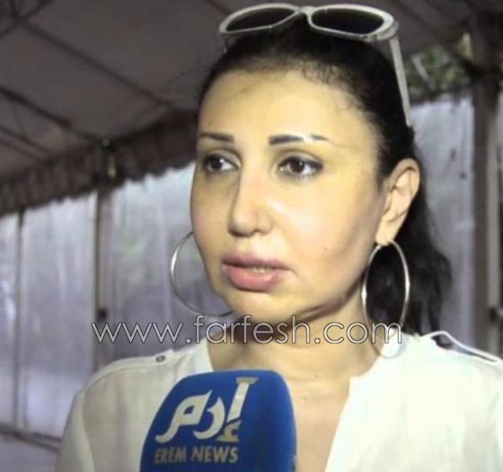 عمليات تجميل فاشلة شوهت الفنانات العربيات بينهن يسرا، غادة وكارمن صورة رقم 5