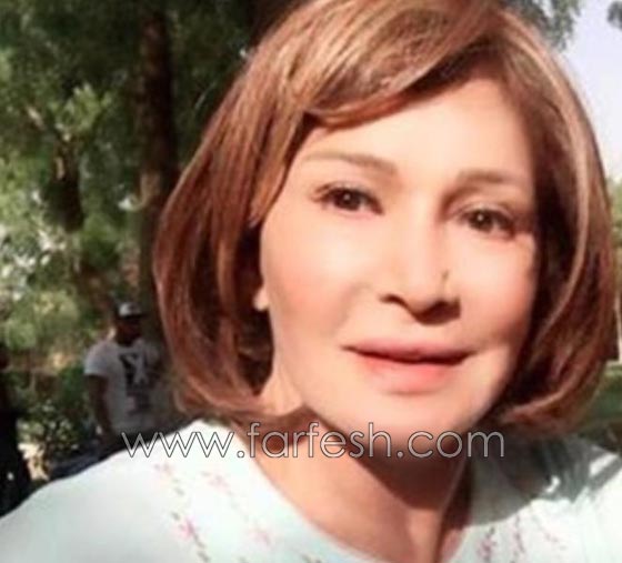 عمليات تجميل فاشلة شوهت الفنانات العربيات بينهن يسرا، غادة وكارمن صورة رقم 6