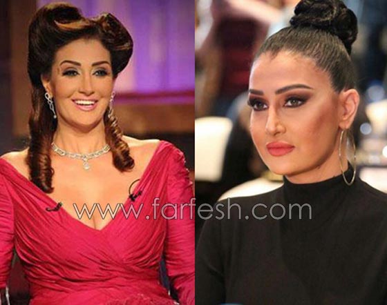 صور فنانات قمن بتكبير الشفاه. بينهن هيفاء واحلام وغادة. الفرق كبير قبل وبعد! صورة رقم 1 صور فنانات قمن بتكبير الشفاه. بينهن هيفاء واحلام وغادة. الفرق كبير قبل وبعد! صورة رقم 1