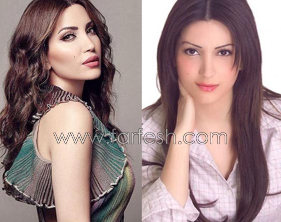 صور فنانات قمن بتكبير الشفاه. بينهن هيفاء واحلام وغادة. الفرق كبير قبل وبعد! صورة رقم 2 صور فنانات قمن بتكبير الشفاه. بينهن هيفاء واحلام وغادة. الفرق كبير قبل وبعد! صورة رقم 2
