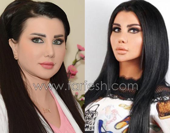 صور فنانات قمن بتكبير الشفاه. بينهن هيفاء واحلام وغادة. الفرق كبير قبل وبعد! صورة رقم 3 صور فنانات قمن بتكبير الشفاه. بينهن هيفاء واحلام وغادة. الفرق كبير قبل وبعد! صورة رقم 3