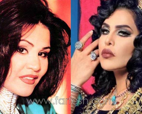 صور فنانات قمن بتكبير الشفاه. بينهن هيفاء واحلام وغادة. الفرق كبير قبل وبعد! صورة رقم 4 صور فنانات قمن بتكبير الشفاه. بينهن هيفاء واحلام وغادة. الفرق كبير قبل وبعد! صورة رقم 4