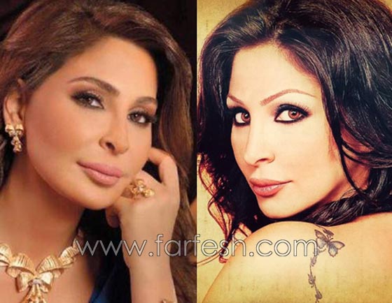 صور فنانات قمن بتكبير الشفاه. بينهن هيفاء واحلام وغادة. الفرق كبير قبل وبعد! صورة رقم 5 صور فنانات قمن بتكبير الشفاه. بينهن هيفاء واحلام وغادة. الفرق كبير قبل وبعد! صورة رقم 5