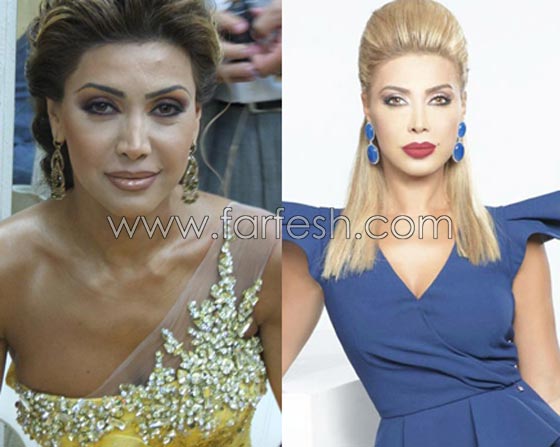 صور فنانات قمن بتكبير الشفاه. بينهن هيفاء واحلام وغادة. الفرق كبير قبل وبعد! صورة رقم 6 صور فنانات قمن بتكبير الشفاه. بينهن هيفاء واحلام وغادة. الفرق كبير قبل وبعد! صورة رقم 6