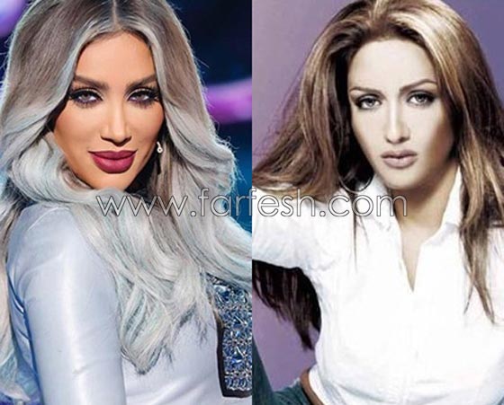 صور فنانات قمن بتكبير الشفاه. بينهن هيفاء واحلام وغادة. الفرق كبير قبل وبعد! صورة رقم 7 صور فنانات قمن بتكبير الشفاه. بينهن هيفاء واحلام وغادة. الفرق كبير قبل وبعد! صورة رقم 7