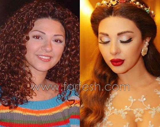 صور فنانات قمن بتكبير الشفاه. بينهن هيفاء واحلام وغادة. الفرق كبير قبل وبعد! صورة رقم 8 صور فنانات قمن بتكبير الشفاه. بينهن هيفاء واحلام وغادة. الفرق كبير قبل وبعد! صورة رقم 8