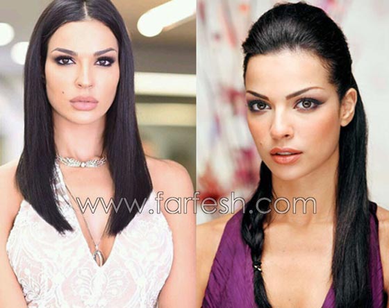 صور فنانات قمن بتكبير الشفاه. بينهن هيفاء واحلام وغادة. الفرق كبير قبل وبعد! صورة رقم 9 صور فنانات قمن بتكبير الشفاه. بينهن هيفاء واحلام وغادة. الفرق كبير قبل وبعد! صورة رقم 9