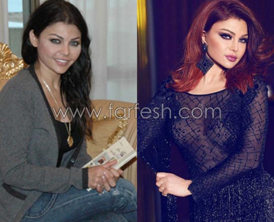 صور فنانات قمن بتكبير الشفاه. بينهن هيفاء واحلام وغادة. الفرق كبير قبل وبعد! صورة رقم 10 صور فنانات قمن بتكبير الشفاه. بينهن هيفاء واحلام وغادة. الفرق كبير قبل وبعد! صورة رقم 10