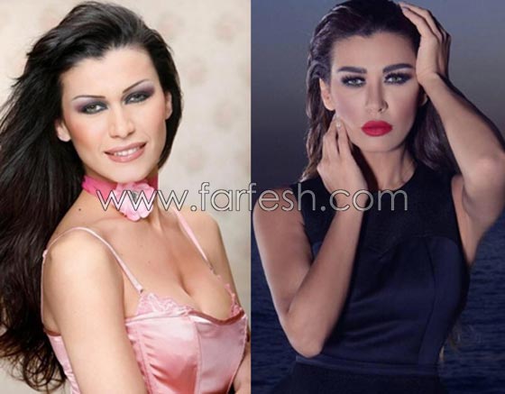 صور فنانات قمن بتكبير الشفاه. بينهن هيفاء واحلام وغادة. الفرق كبير قبل وبعد! صورة رقم 12 صور فنانات قمن بتكبير الشفاه. بينهن هيفاء واحلام وغادة. الفرق كبير قبل وبعد! صورة رقم 12