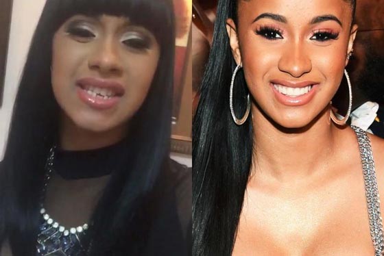 10 نجمات من هوليوود يعترفن بإجراء عمليات التجميل - صور قبل وبعد صورة رقم 1 10 نجمات من هوليوود يعترفن بإجراء عمليات التجميل - صور قبل وبعد صورة رقم 1