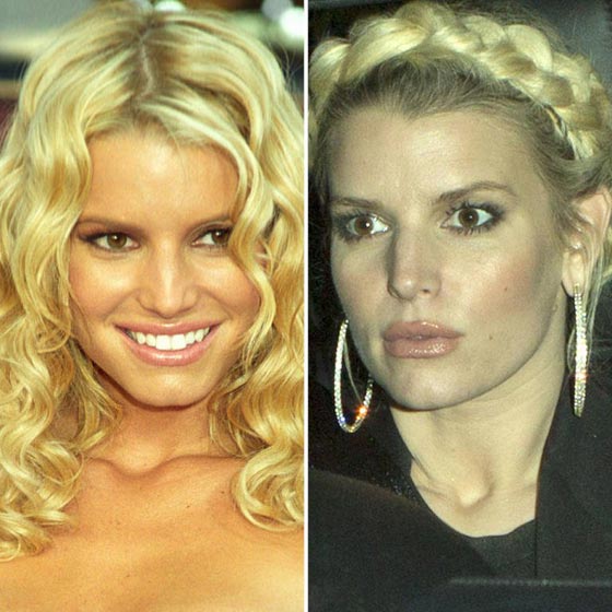 10 نجمات من هوليوود يعترفن بإجراء عمليات التجميل - صور قبل وبعد صورة رقم 8 10 نجمات من هوليوود يعترفن بإجراء عمليات التجميل - صور قبل وبعد صورة رقم 8