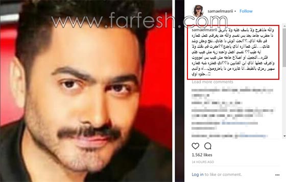 سما المصري تفضح غمازة تامر حسني: كيف عملتها؟! صورة رقم 1 سما المصري تفضح غمازة تامر حسني: كيف عملتها؟! صورة رقم 1