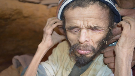 قصة صادمة: تونسي عاش 15 عاماً في كهف ويعيش على أكل الديدان حتى أصبح وزنه 10 كيلو صورة رقم 1