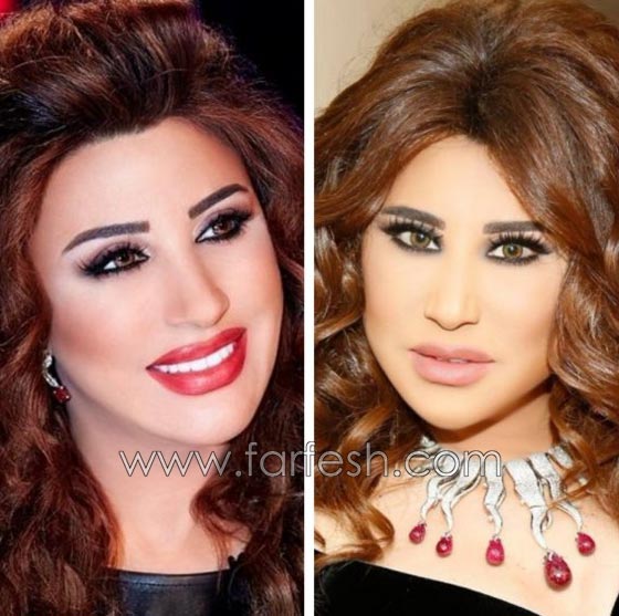بالفيديو نجوى كرم تعترف بكل جرأة: لهذا السبب تورّم وجهي! صورة رقم 1 بالفيديو نجوى كرم تعترف بكل جرأة: لهذا السبب تورّم وجهي! صورة رقم 1