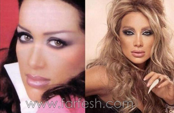 صور نجوم العرب قبل الشهرة.. حسب رأيكم هل غير المال مظهرهم؟ صورة رقم 10