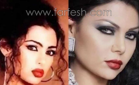 صور نجوم العرب قبل الشهرة والثراء.. هل غيّر المال مظهرهم؟ صورة رقم 2 صور نجوم العرب قبل الشهرة والثراء.. هل غيّر المال مظهرهم؟ صورة رقم 2