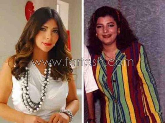 صور نجوم العرب قبل الشهرة والثراء.. هل غيّر المال مظهرهم؟ صورة رقم 5 صور نجوم العرب قبل الشهرة والثراء.. هل غيّر المال مظهرهم؟ صورة رقم 5