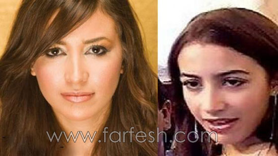 صور نجوم العرب قبل الشهرة والثراء.. هل غيّر المال مظهرهم؟ صورة رقم 7 صور نجوم العرب قبل الشهرة والثراء.. هل غيّر المال مظهرهم؟ صورة رقم 7