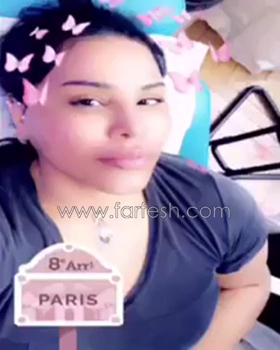 فيديو احلام بدون مكياج تكشف عن خضوعها لعملية تجميل وحقن الشفاه! صورة رقم 1 فيديو احلام بدون مكياج تكشف عن خضوعها لعملية تجميل وحقن الشفاه! صورة رقم 1