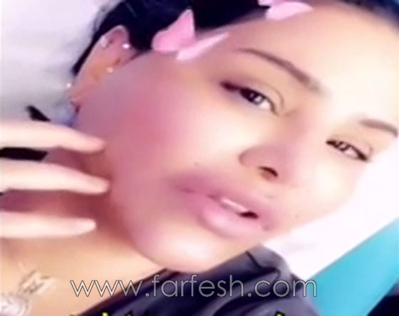 فيديو احلام بدون مكياج تكشف عن خضوعها لعملية تجميل وحقن الشفاه! صورة رقم 2 فيديو احلام بدون مكياج تكشف عن خضوعها لعملية تجميل وحقن الشفاه! صورة رقم 2
