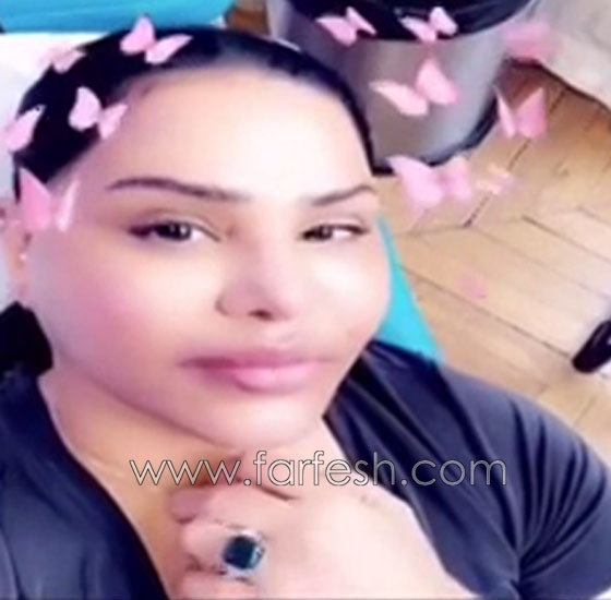 فيديو احلام بدون مكياج تكشف عن خضوعها لعملية تجميل وحقن الشفاه! صورة رقم 3 فيديو احلام بدون مكياج تكشف عن خضوعها لعملية تجميل وحقن الشفاه! صورة رقم 3