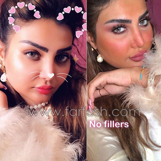 فنانة كويتية تبالغ بعمليات التجميل والجمهور: سينفجر وجهك من كثرة النفخ! صورة رقم 1 فنانة كويتية تبالغ بعمليات التجميل والجمهور: سينفجر وجهك من كثرة النفخ! صورة رقم 1
