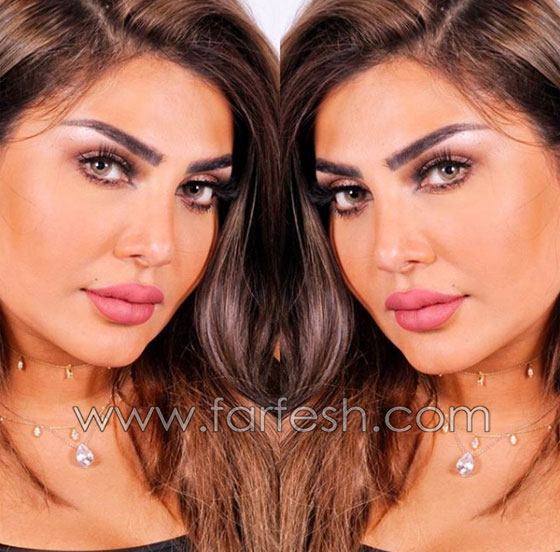 فنانة كويتية تبالغ بعمليات التجميل والجمهور: سينفجر وجهك من كثرة النفخ! صورة رقم 9 فنانة كويتية تبالغ بعمليات التجميل والجمهور: سينفجر وجهك من كثرة النفخ! صورة رقم 9