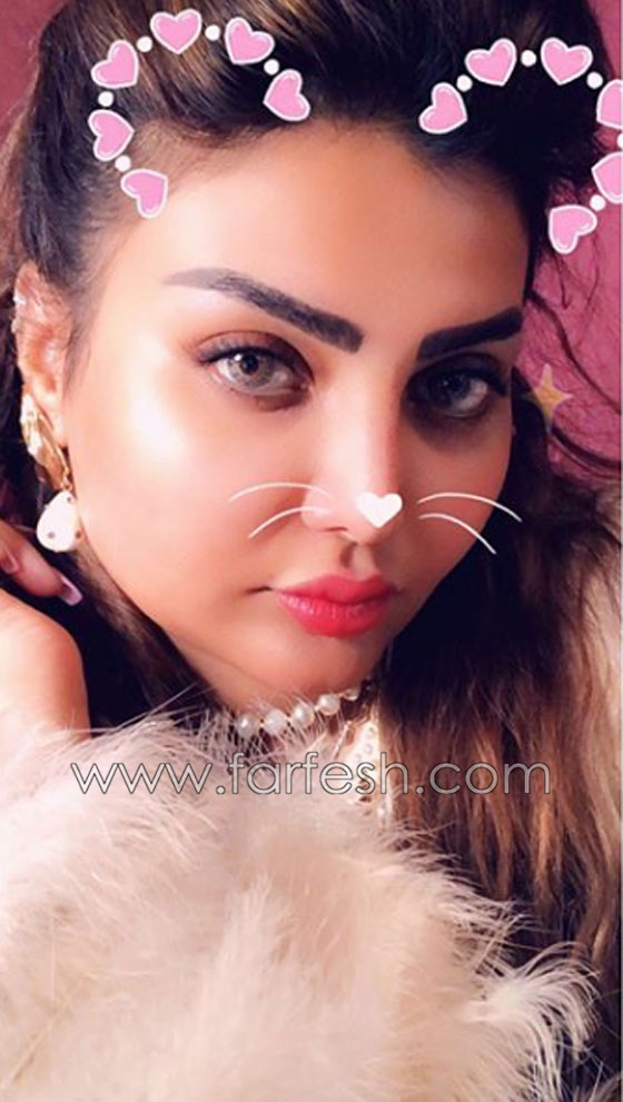 فنانة كويتية تبالغ بعمليات التجميل والجمهور: سينفجر وجهك من كثرة النفخ! صورة رقم 2 فنانة كويتية تبالغ بعمليات التجميل والجمهور: سينفجر وجهك من كثرة النفخ! صورة رقم 2