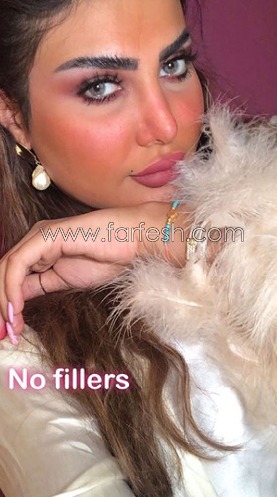فنانة كويتية تبالغ بعمليات التجميل والجمهور: سينفجر وجهك من كثرة النفخ! صورة رقم 3 فنانة كويتية تبالغ بعمليات التجميل والجمهور: سينفجر وجهك من كثرة النفخ! صورة رقم 3