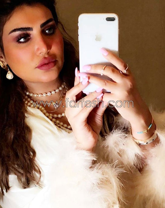 فنانة كويتية تبالغ بعمليات التجميل والجمهور: سينفجر وجهك من كثرة النفخ! صورة رقم 10 فنانة كويتية تبالغ بعمليات التجميل والجمهور: سينفجر وجهك من كثرة النفخ! صورة رقم 10