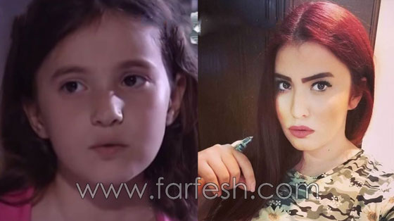 بالصور: هكذا أصبح أطفال المسلسلات السورية بعد سنوات طويلة صورة رقم 5 بالصور: هكذا أصبح أطفال المسلسلات السورية بعد سنوات طويلة صورة رقم 5
