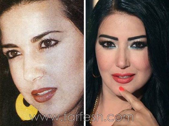 صور 14 فنانة مصرية قبل وبعد عمليات التجميل.. الفرق هائل! صورة رقم 3