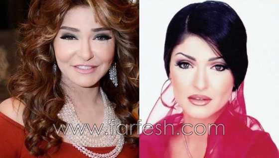 صور 14 فنانة مصرية قبل وبعد عمليات التجميل.. الفرق هائل! صورة رقم 7