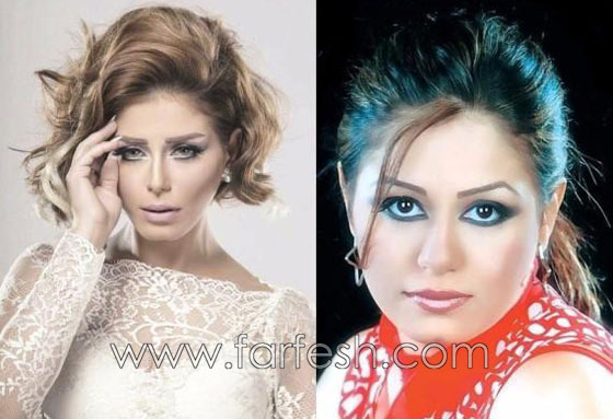 صور 14 فنانة مصرية قبل وبعد عمليات التجميل.. الفرق هائل! صورة رقم 11