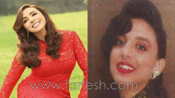 صور 14 فنانة مصرية قبل وبعد عمليات التجميل.. الفرق هائل! صورة رقم 14
