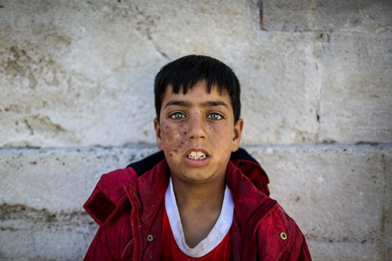 دراسة بعنوان: الأطفال السوريون.. شبح في إسطنبول صورة رقم 10