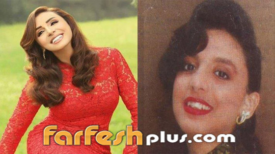 صور نجمات الفن قبل وبعد عمليات التجميل.. البعض تشوه وجههن! صورة رقم 27