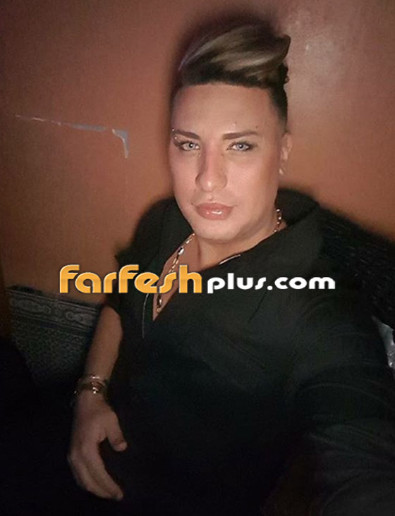 ما سبب وفاة هواري المنار مغني الراي الجزائري أثناء جراحة شفط دهون؟ صورة رقم 7 ما سبب وفاة هواري المنار مغني الراي الجزائري أثناء جراحة شفط دهون؟ صورة رقم 7