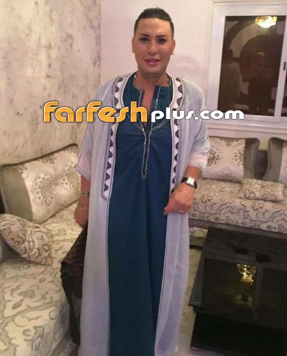 ما سبب وفاة هواري المنار مغني الراي الجزائري أثناء جراحة شفط دهون؟ صورة رقم 11 ما سبب وفاة هواري المنار مغني الراي الجزائري أثناء جراحة شفط دهون؟ صورة رقم 11